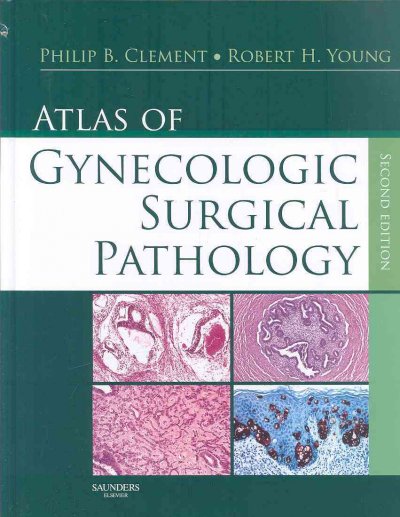 Atlas of gynecologic surgical pathology / Philip B. Clement, Robert H. Young.